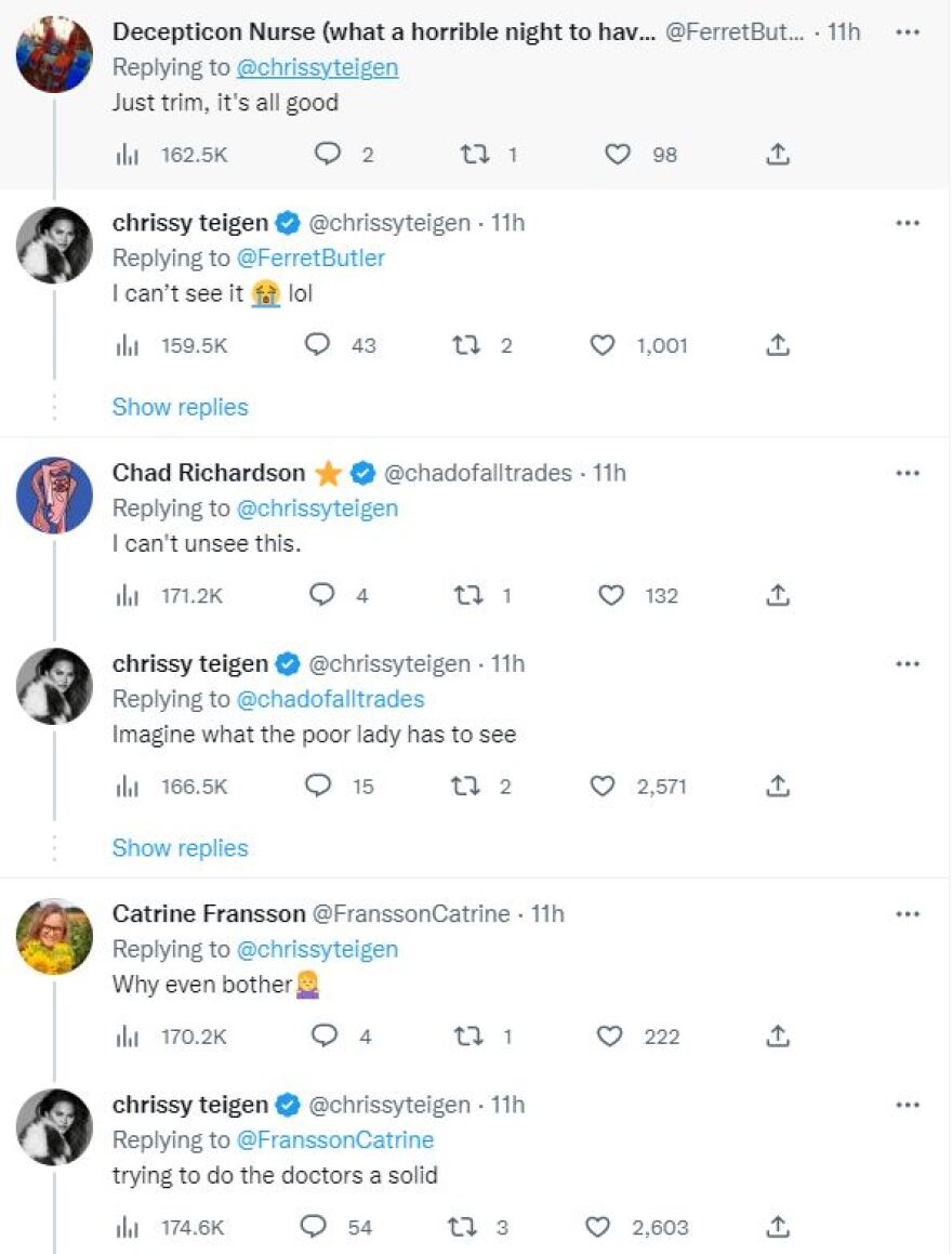 Κρίσι Τέιγκεν: Ζητά συμβουλές για την αποτρίχωση στο μπικίνι λίγο πριν γεννήσει