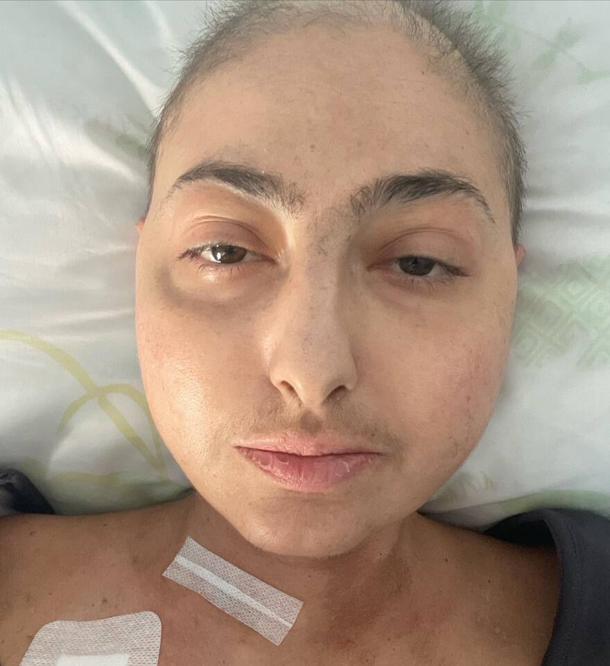 Ρεγγίνα Μακέδου για χημειοθεραπείες: «Ξέρεις τι είναι να βλέπεις τον εαυτό σου στον καθρέφτη παραμορφωμένο;»