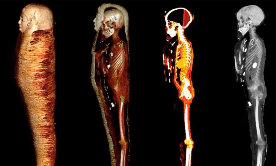 Η μούμια του «Χρυσού Αγοριού» αποκαλύπτει τα μυστικά της και τα 49 κρυφά φυλαχτά της