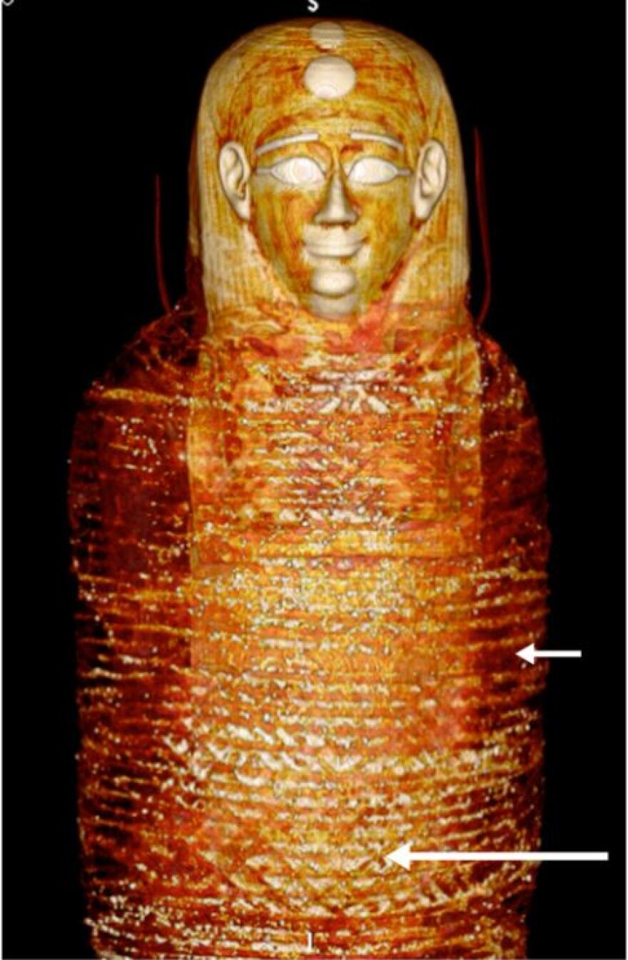 Η μούμια του «Χρυσού Αγοριού» αποκαλύπτει τα μυστικά της και τα 49 κρυφά φυλαχτά της