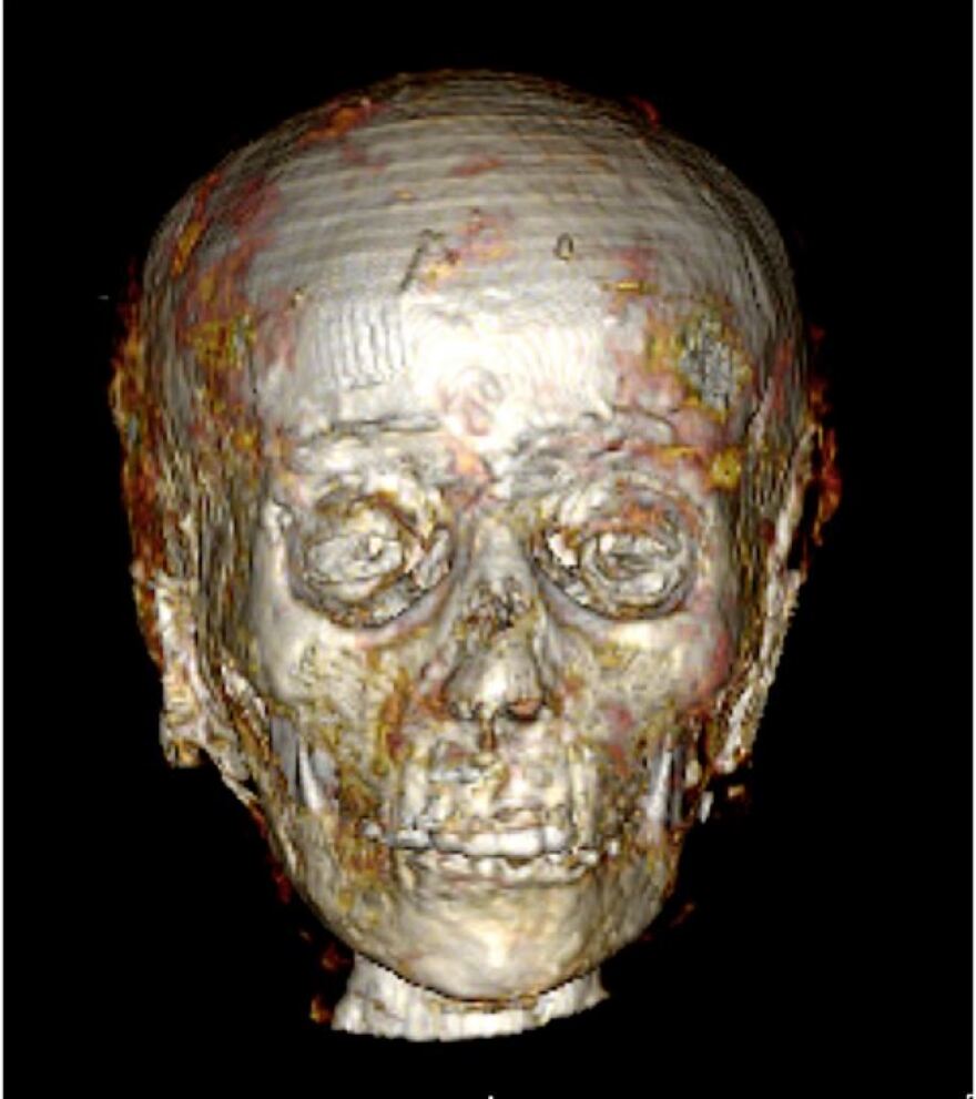 Η μούμια του «Χρυσού Αγοριού» αποκαλύπτει τα μυστικά της και τα 49 κρυφά φυλαχτά της