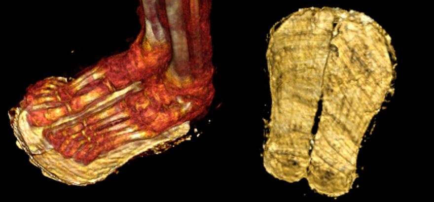 Η μούμια του «Χρυσού Αγοριού» αποκαλύπτει τα μυστικά της και τα 49 κρυφά φυλαχτά της