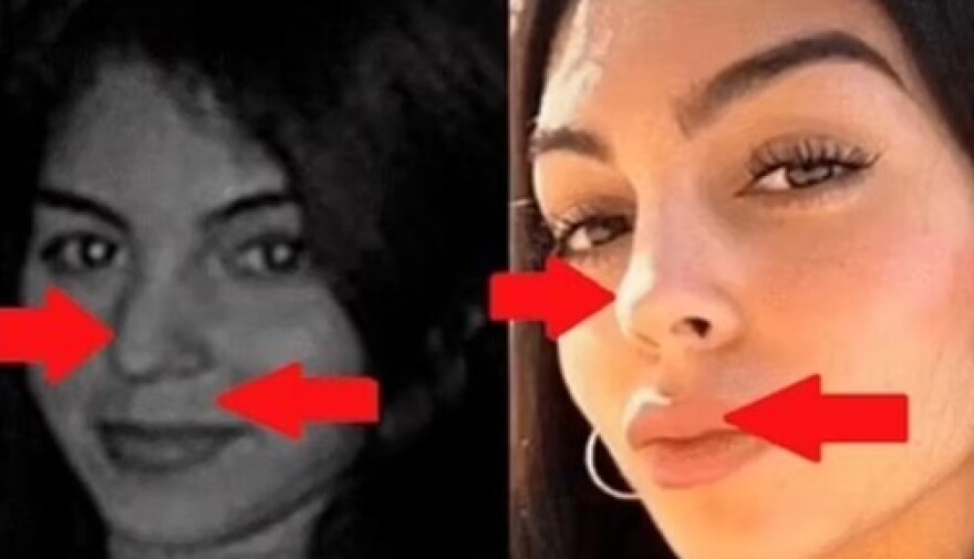 Ρονάλντο: Πρώην του έβαλε στο «μάτι» τη Ροντρίγκεζ για τις πλαστικές - «Μεταμορφώθηκε σε Καρντάσιαν»