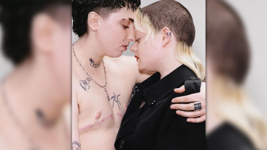 Burberry: Οργή για την καμπάνια της Burberry με μοντέλο που έχει αφαιρέσει το στήθος του