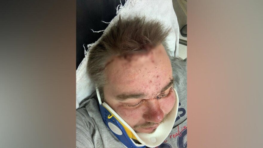 Ρώσος φαρσέρ: Είχε καταγράψει σε live μετάδοση τον άγριο ξυλοδαρμό του στην Περαία!