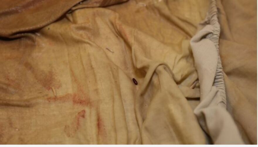 Βρετανία: Φωτογραφίες αποτυπώνουν την εξαθλίωση στην οποία ζούσε μια ανάπηρη 16χρονη πριν πεθάνει