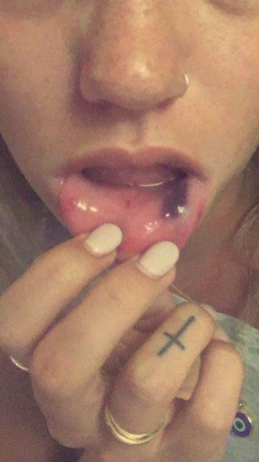 Γλυφάδα: Συγκλονίζουν οι φωτογραφίες από τα χτυπήματα που δέχτηκε το μοντέλο από τον dj πρώην της