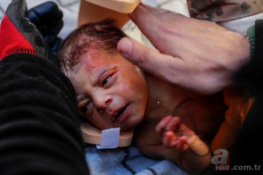 Σεισμός στην Τουρκία: Μωράκι 20 ημερών σώθηκε μετά από 60 ώρες - Κρατούσε μία τούφα από τα μαλλιά της μητέρας του