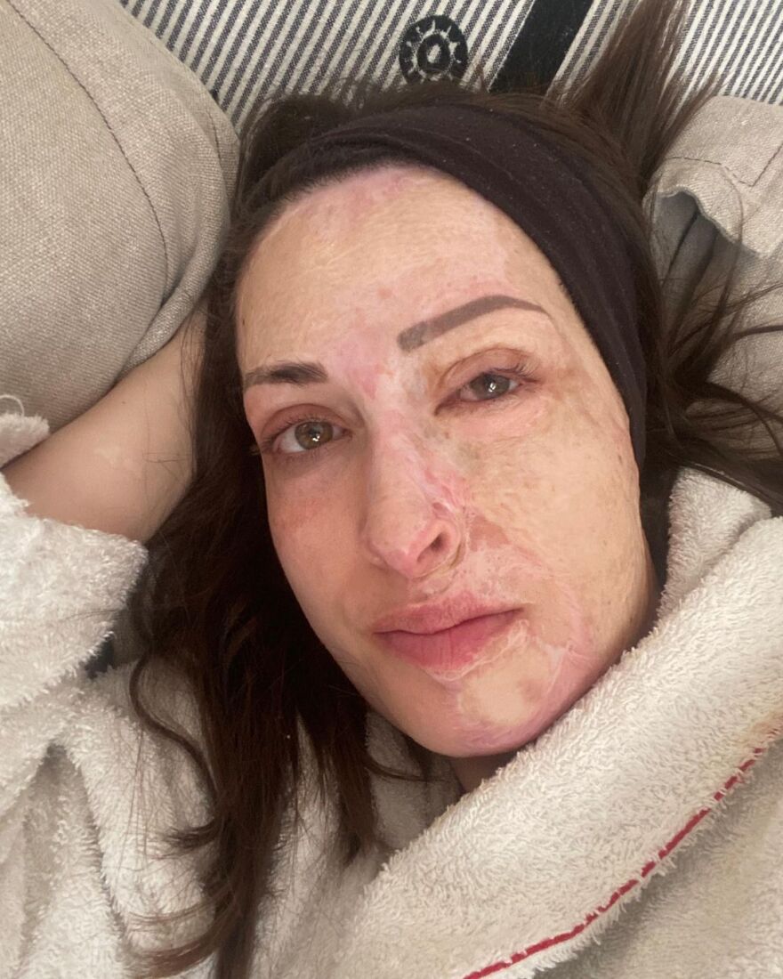 Ιωάννα Παλιοσπύρου: «Ακόμα παλεύω να αποδεχτώ τον νέο μου εαυτό» - Το μήνυμα για την ημέρα του Αγίου Βαλεντίνου