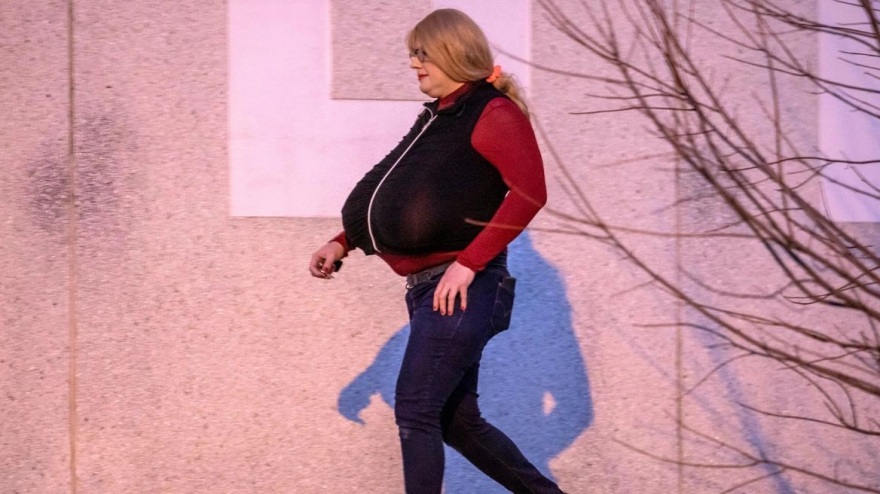 Η Καναδή καθηγήτρια με το τεράστιο στήθος λέει πως είναι αληθινό - «Έχω γιγαντομαστία»