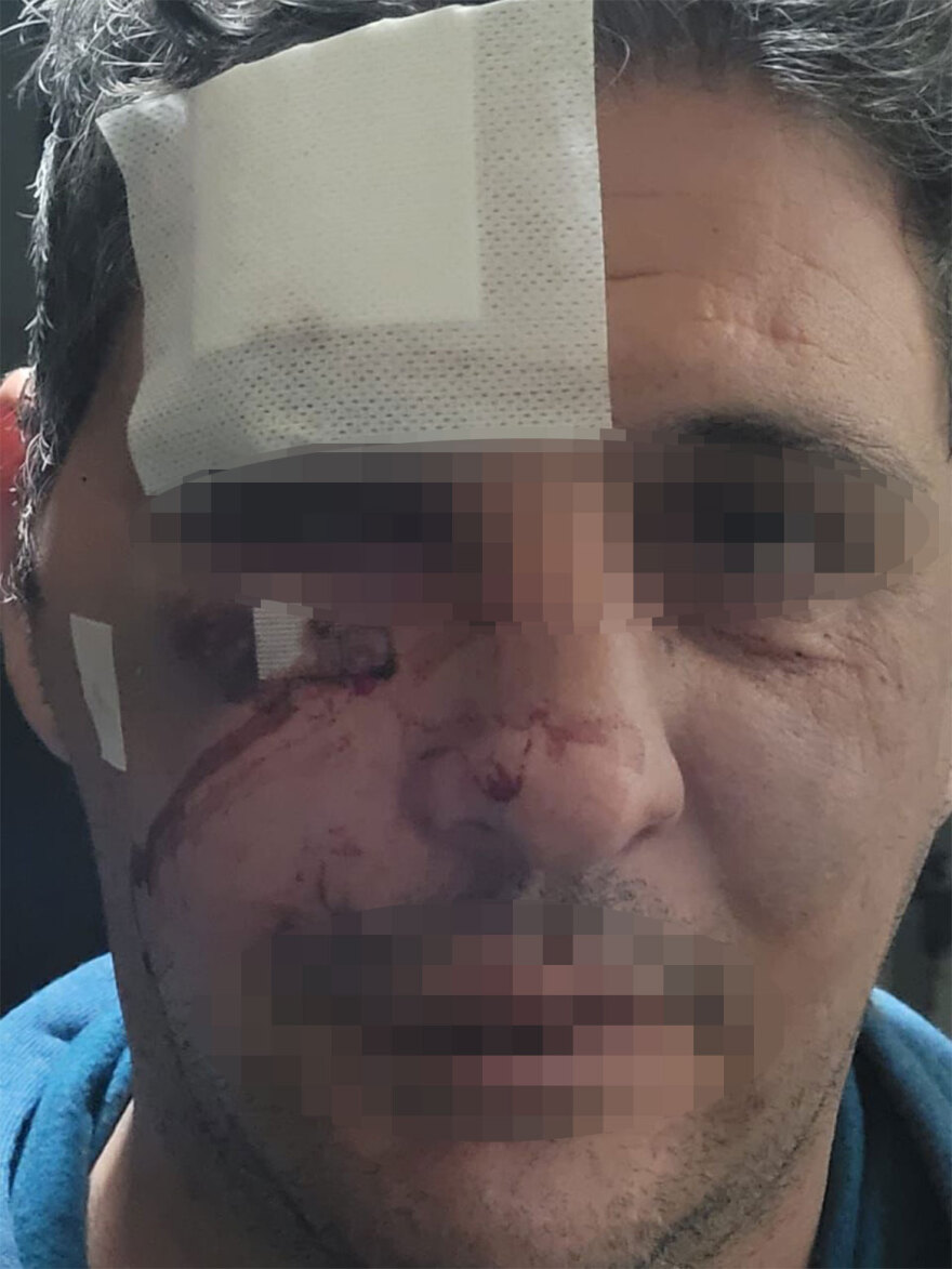 Super Κική: «Είναι η πιο ηλίθια σύλληψη που έχει γίνει ποτέ»