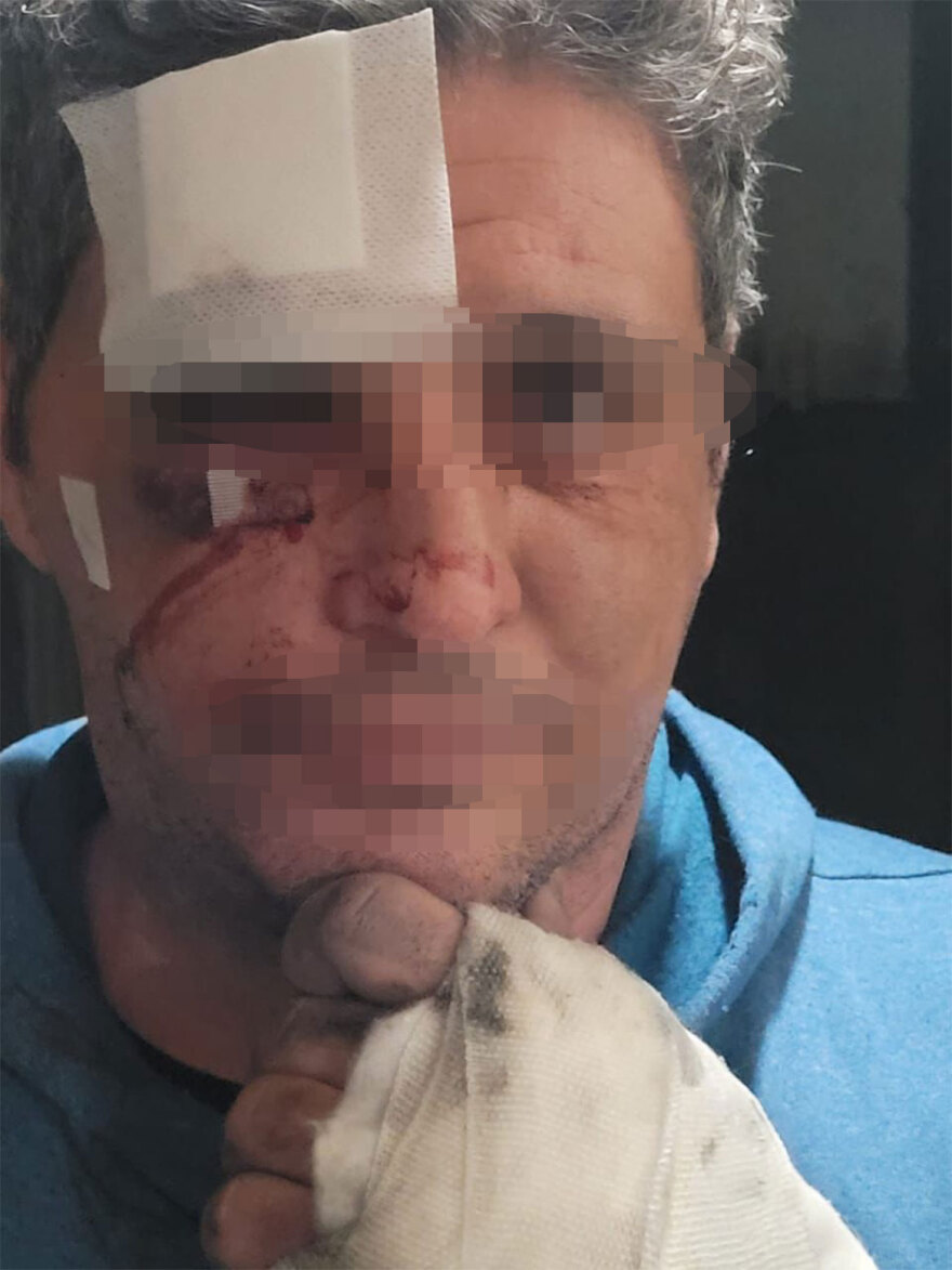 Ελεύθερη με περιοριστικούς όρους η Super Κική