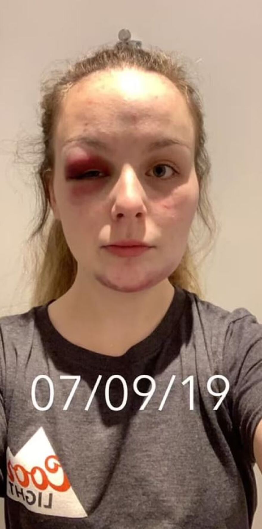 Βρετανία: Σκηνοθέτησε τον βιασμό της και καταδικάστηκε σε οχτώ χρόνια φυλάκιση - Εμπνεύστηκε από ταινίες και σειρές