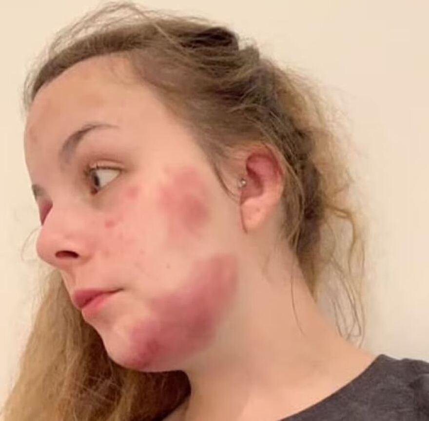 Βρετανία: Σκηνοθέτησε τον βιασμό της και καταδικάστηκε σε οχτώ χρόνια φυλάκιση - Εμπνεύστηκε από ταινίες και σειρές