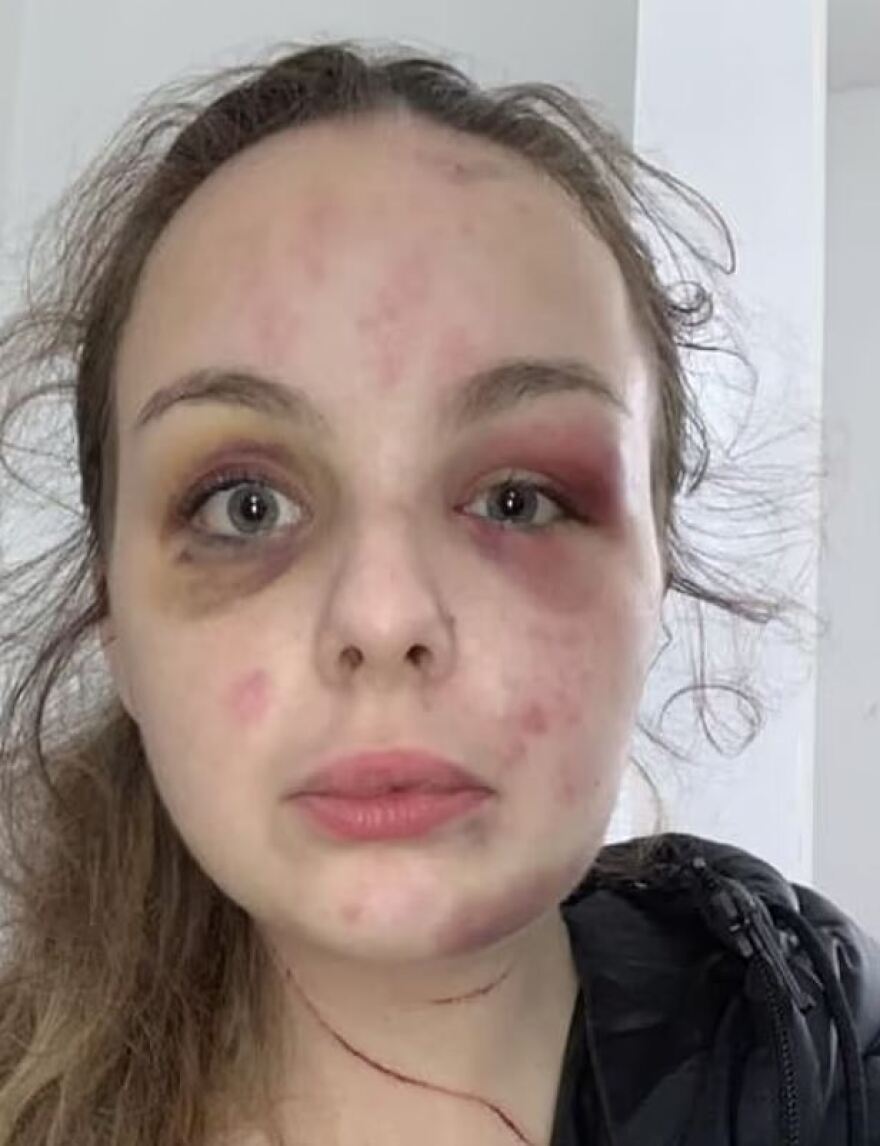 Βρετανία: Σκηνοθέτησε τον βιασμό της και καταδικάστηκε σε οχτώ χρόνια φυλάκιση - Εμπνεύστηκε από ταινίες και σειρές