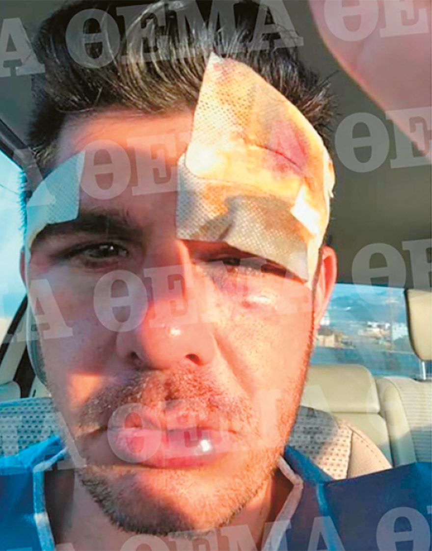 Μύκονος: H μαφία κλείνει στόματα με άγριο ξύλο