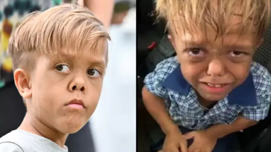 Κουάντεν Μπέιλς: Από άγριο θύμα bullying σε ταινία με τον Κρις Χέμσγουορθ!