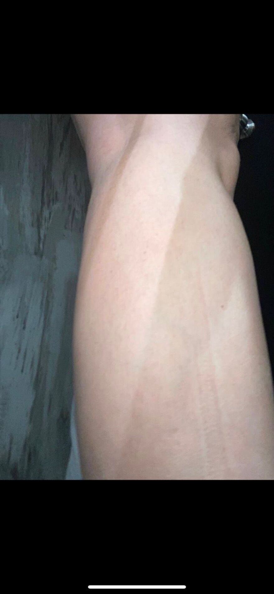 Βούλα: 43χρονη καταγγέλλει άγριο ξυλοδαρμό από τον επιχειρηματία πρώην σύζυγό της