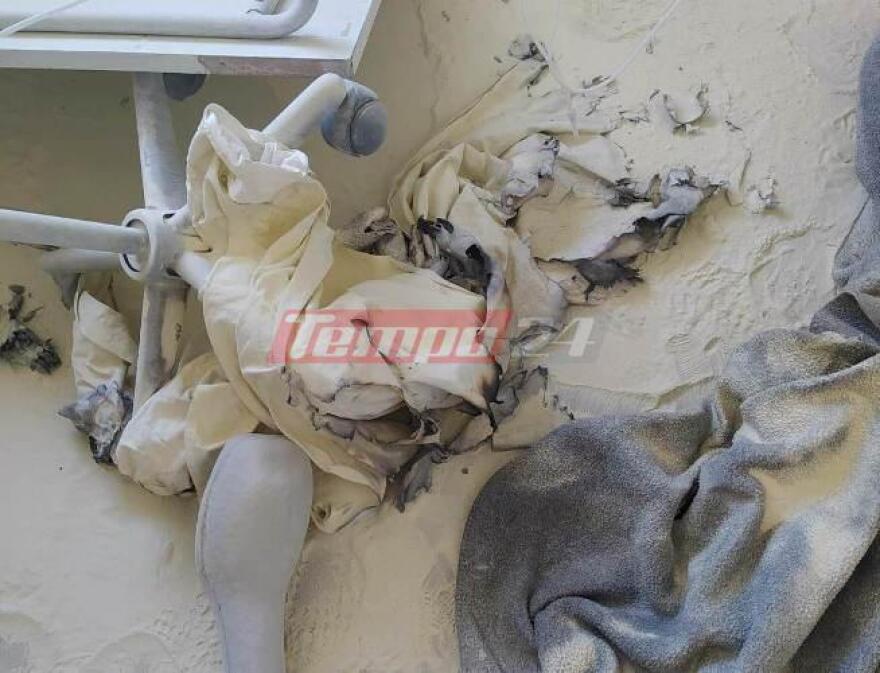 Νοσοκομείο Ρίου: Διασωληνώθηκε ο ασθενής που έβαλε φωτιά με τσιγάρο στο στρώμα του (φωτογραφίες)