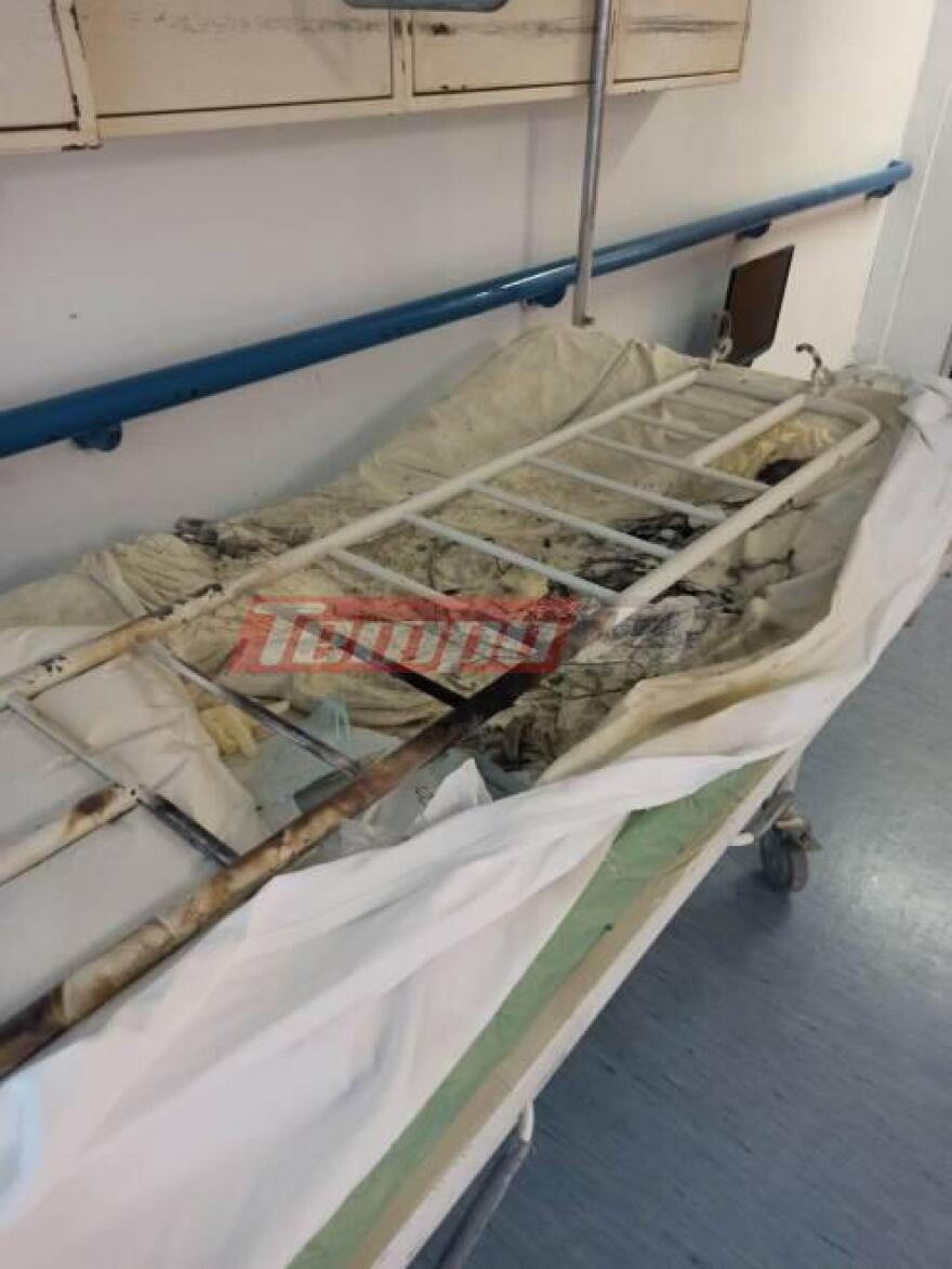 Νοσοκομείο Ρίου: Διασωληνώθηκε ο ασθενής που έβαλε φωτιά με τσιγάρο στο στρώμα του (φωτογραφίες)