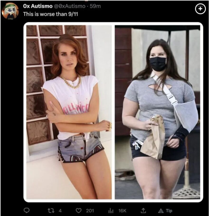 Lana Del Ray: Δέχεται bullying για τα παραπανίσια κιλά της