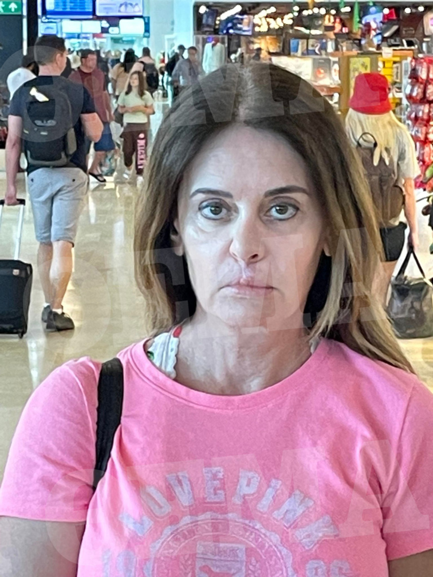 Πώς είναι σήμερα η Ελληνίδα συγγραφέας που είδε τα χείλη της να «σαπίζουν» μετά από πλαστική επέμβαση