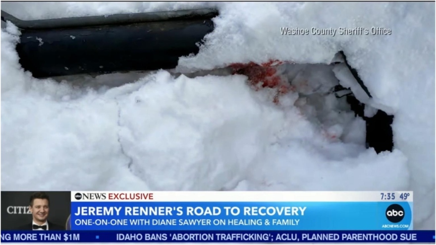 Τζέρεμι Ρένερ: Οι πρώτες φωτογραφίες από το ατύχημα με το εκχιονιστικό