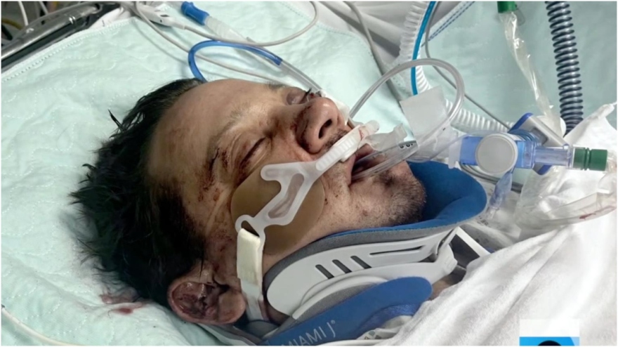 Τζέρεμι Ρένερ: Οι πρώτες φωτογραφίες από το ατύχημα με το εκχιονιστικό