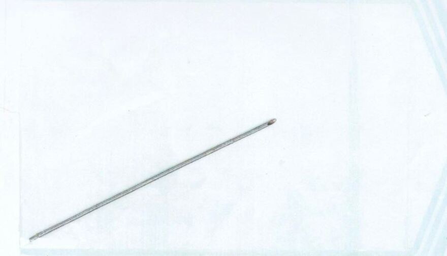 Θεσσαλονίκη: «Ζω από θαύμα», λέει η γυναίκα που είχε βελόνα... 13 εκατοστών στην κοιλιά της!