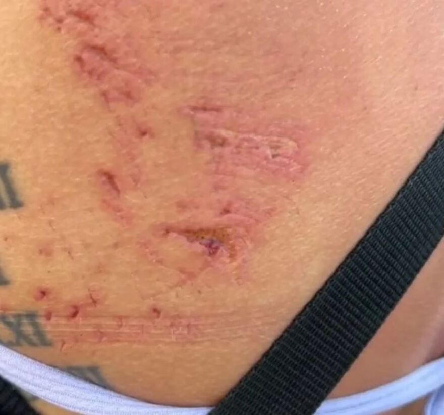 Μαλδίβες; Καρχαρίας 100 κιλών δάγκωσε κολυμβήτρια - Δείτε βίντεο