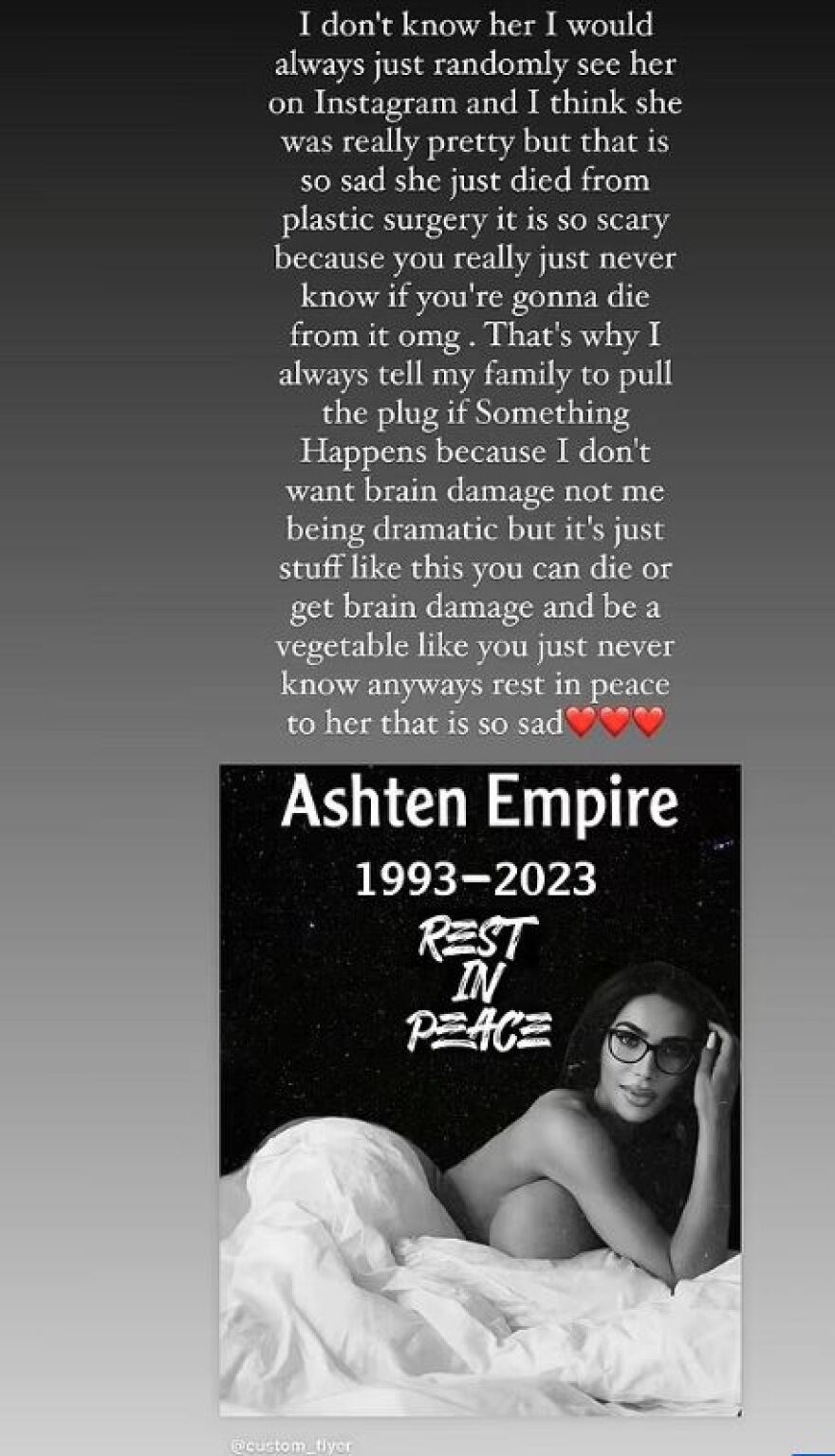 Σωσίας της Κιμ Καρντάσιαν και μοντέλο του Onlyfans πέθανε από ανακοπή μετά από πλαστική επέμβαση