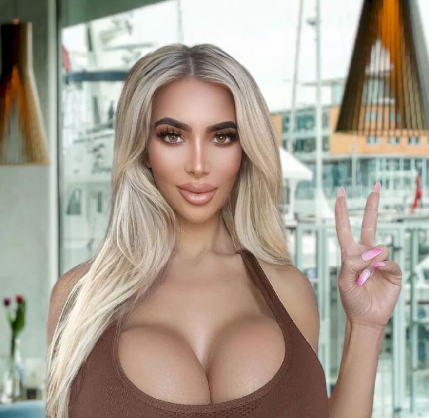 Σωσίας της Κιμ Καρντάσιαν και μοντέλο του Onlyfans πέθανε από ανακοπή μετά από πλαστική επέμβαση