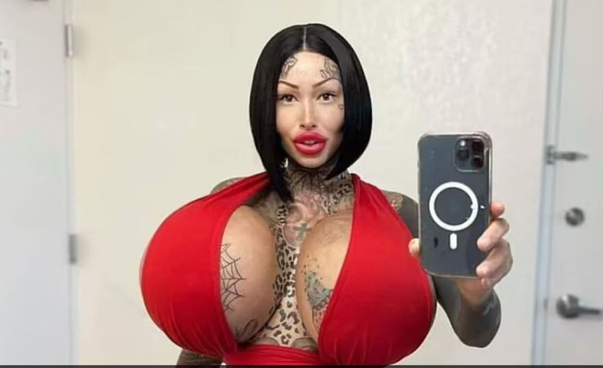 Σωσίας της Κιμ Καρντάσιαν και μοντέλο του Onlyfans πέθανε από ανακοπή μετά από πλαστική επέμβαση