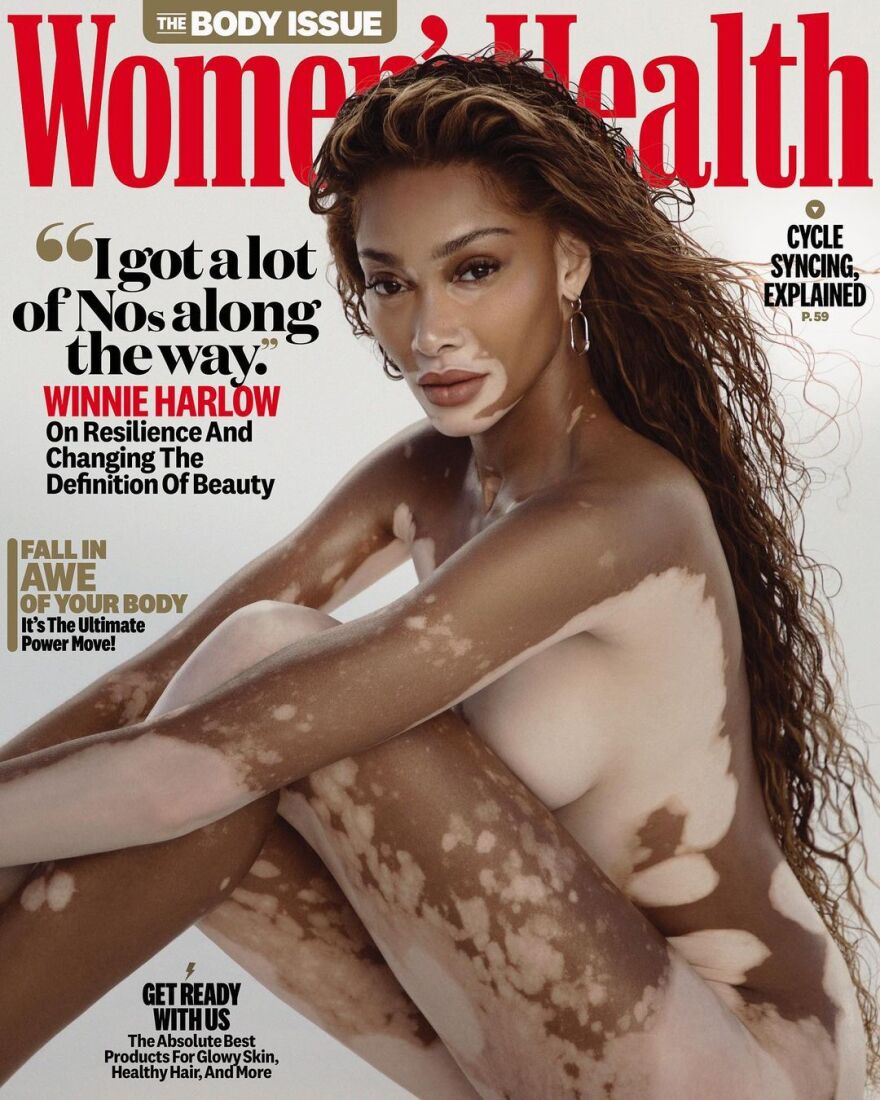 Γουίνι Χάρλοου: Φωτογραφήθηκε γυμνή