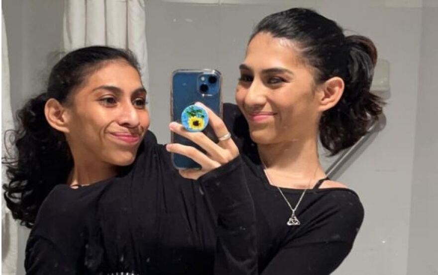 Σιαμαίες δίδυμες εξηγούν πώς «λειτουργεί» η προσωπική τους ζωή - H μία asexual, η άλλη με αγόρι 