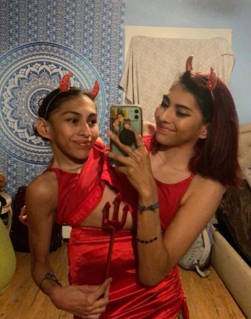 Σιαμαίες δίδυμες εξηγούν πώς «λειτουργεί» η προσωπική τους ζωή - H μία asexual, η άλλη με αγόρι 