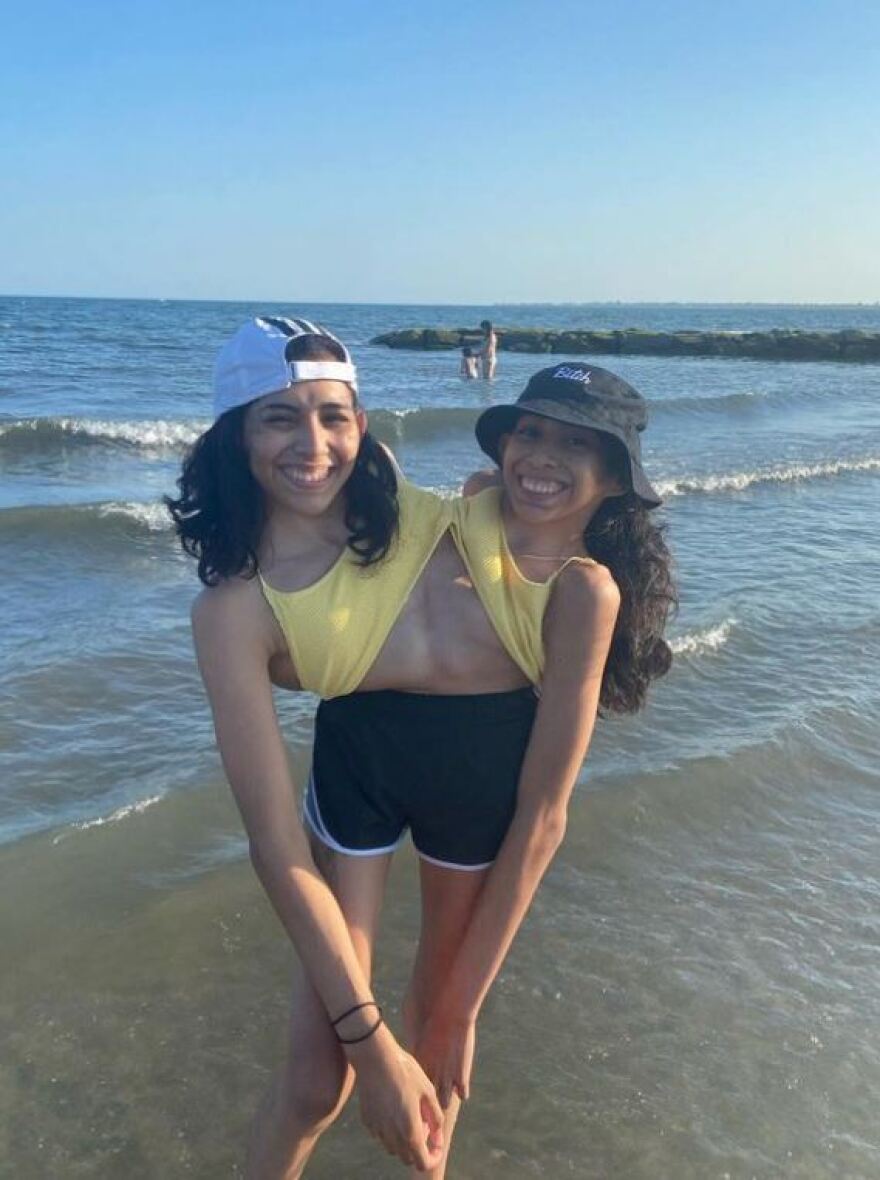 Σιαμαίες δίδυμες εξηγούν πώς «λειτουργεί» η προσωπική τους ζωή - H μία asexual, η άλλη με αγόρι 