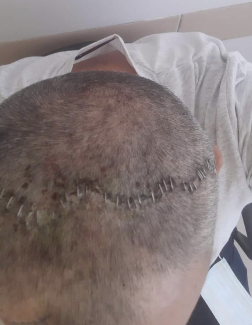 Καταδικάστηκε και σε δεύτερο βαθμό ο αγρότης που σακάτεψε αστυνομικό στους Παξούς - «Μου επιτέθηκε χωρίς καν να τον ξέρω»