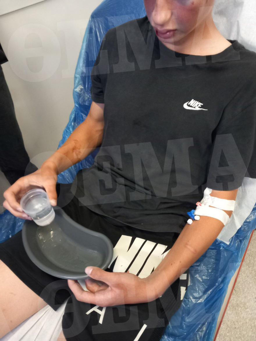 Καλαμάτα: Άγριο ξύλο σε δυο ανήλικους από συμμορία συνομηλίκων τους