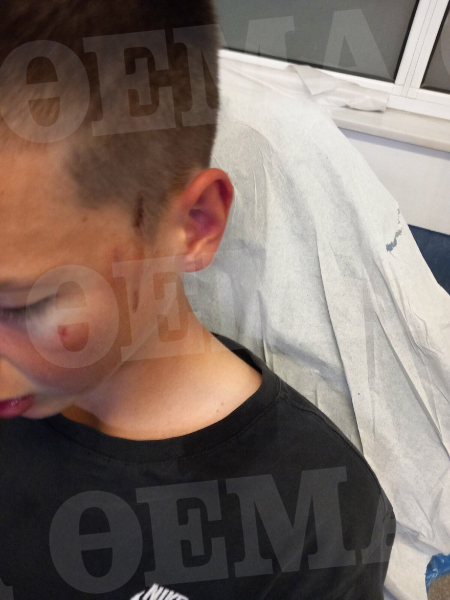 Καλαμάτα: Άγριο ξύλο σε δυο ανήλικους από συμμορία συνομηλίκων τους