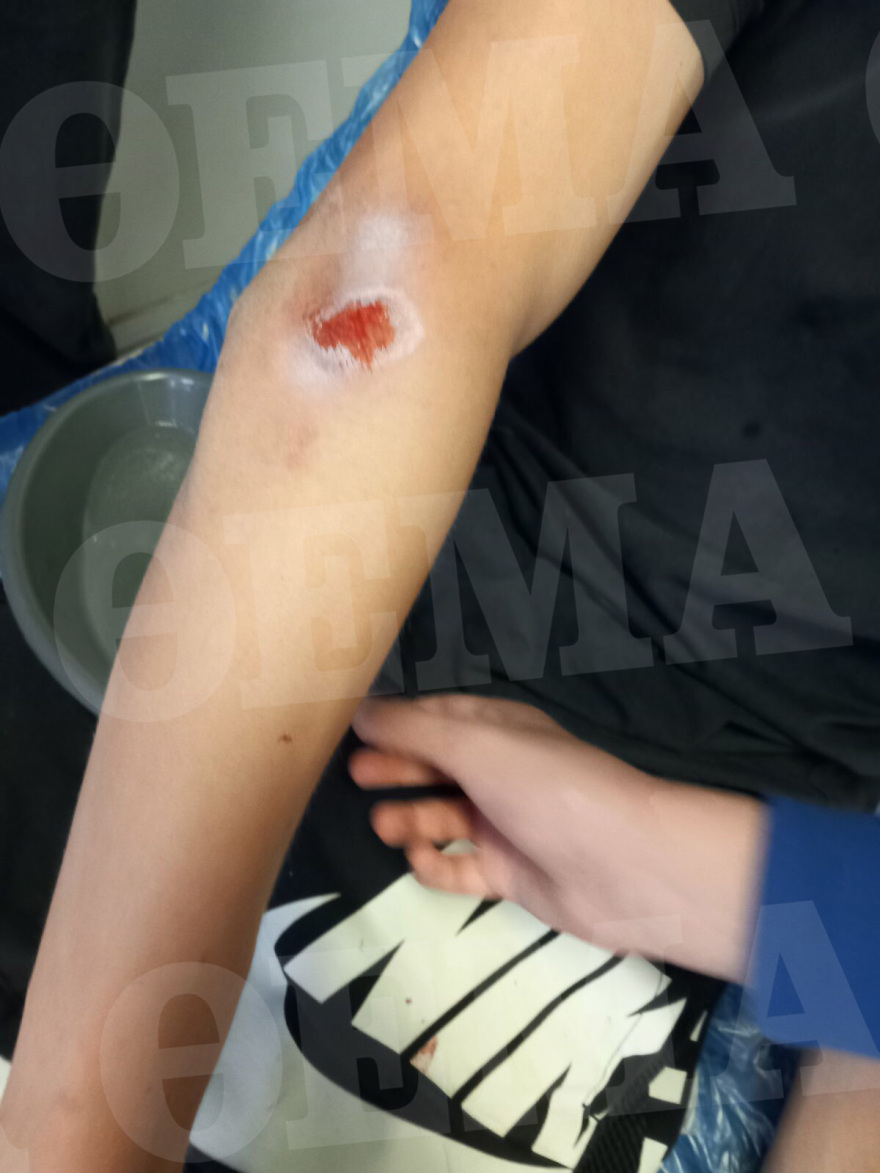 Καλαμάτα: Άγριο ξύλο σε δυο ανήλικους από συμμορία συνομηλίκων τους