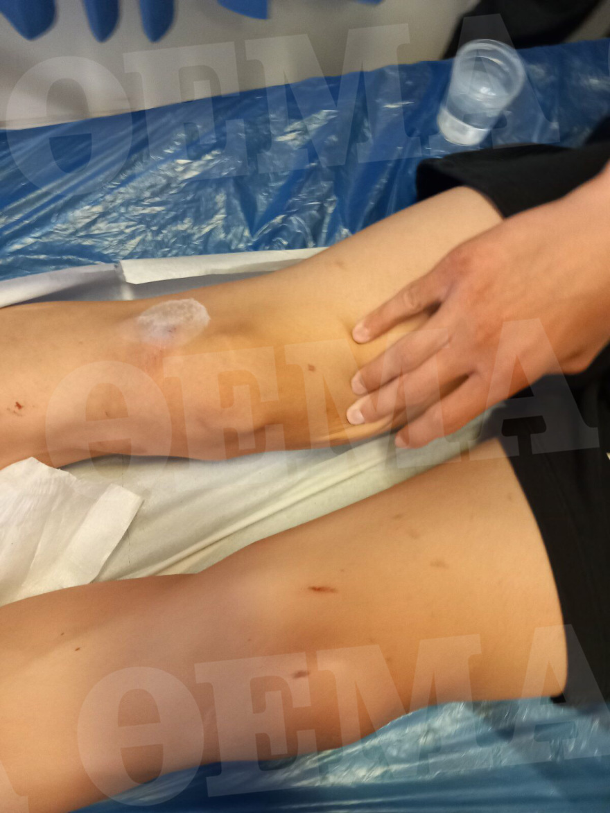 Καλαμάτα: Άγριο ξύλο σε δυο ανήλικους από συμμορία συνομηλίκων τους