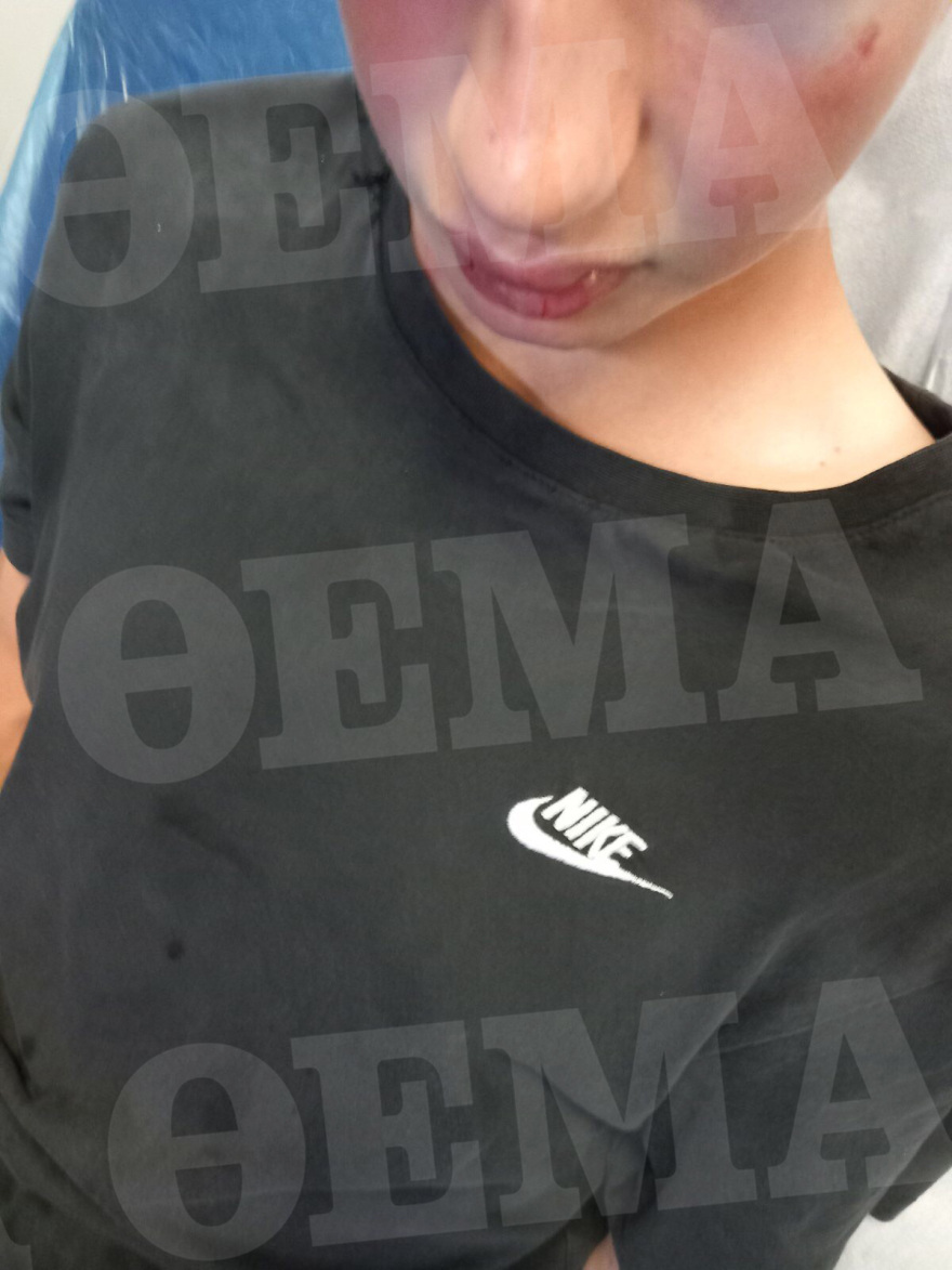 Καλαμάτα: Άγριο ξύλο σε δυο ανήλικους από συμμορία συνομηλίκων τους