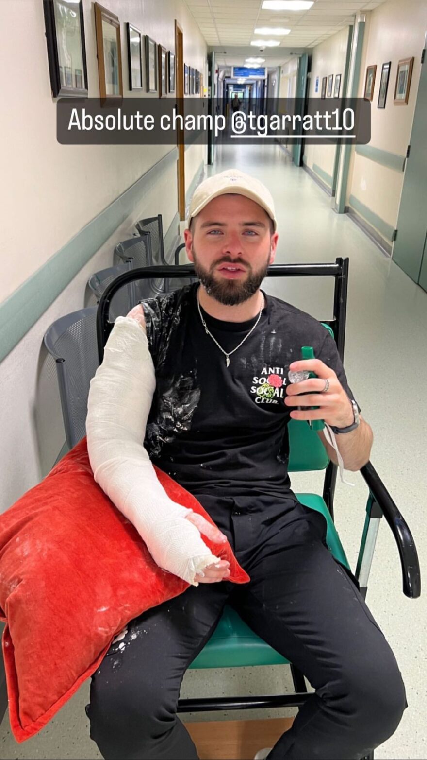 Αστέρας του TikTok έσπασε το χέρι του σε μπρα ντε φερ σε ζωντανή μετάδοση