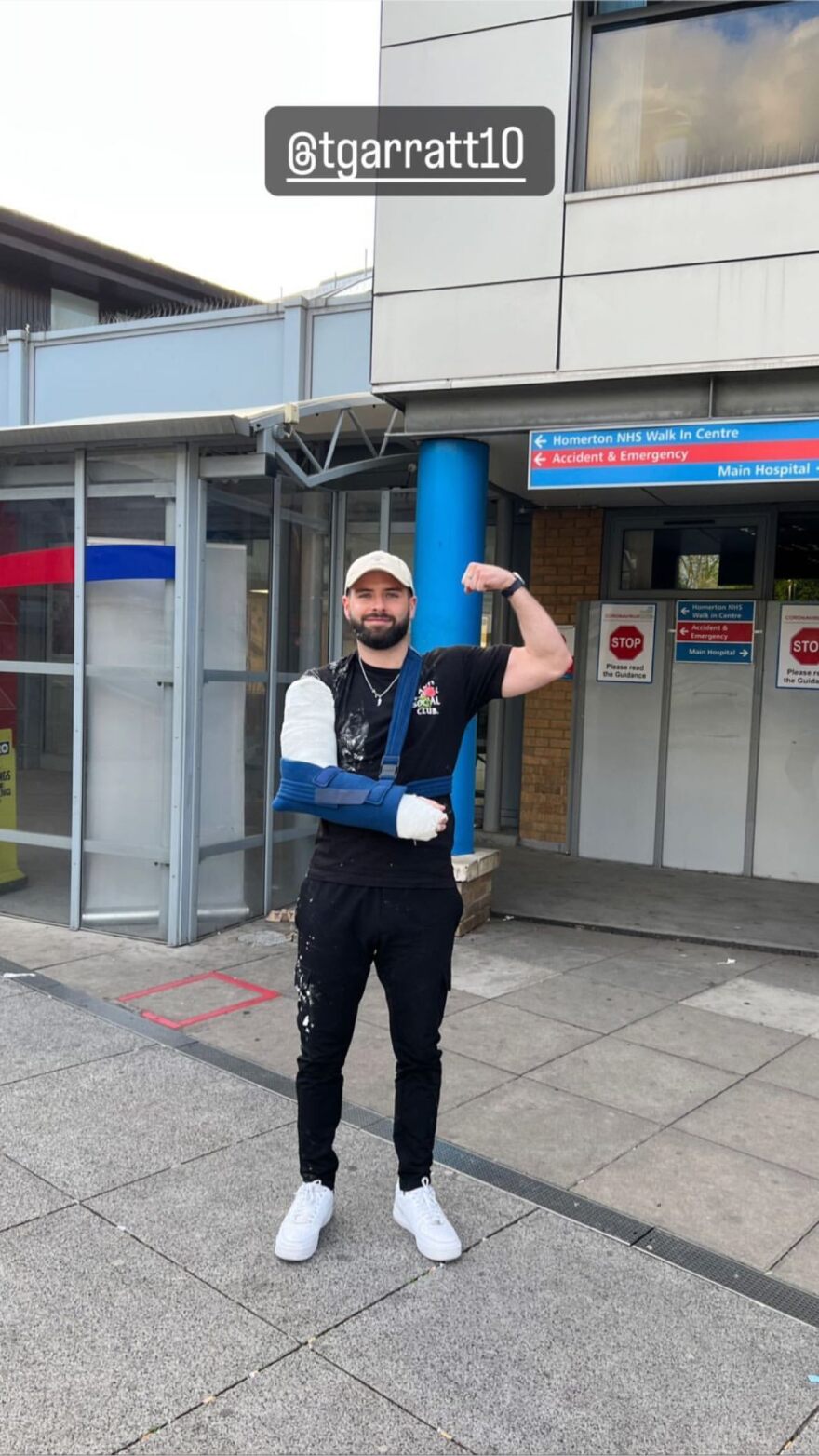 Αστέρας του TikTok έσπασε το χέρι του σε μπρα ντε φερ σε ζωντανή μετάδοση