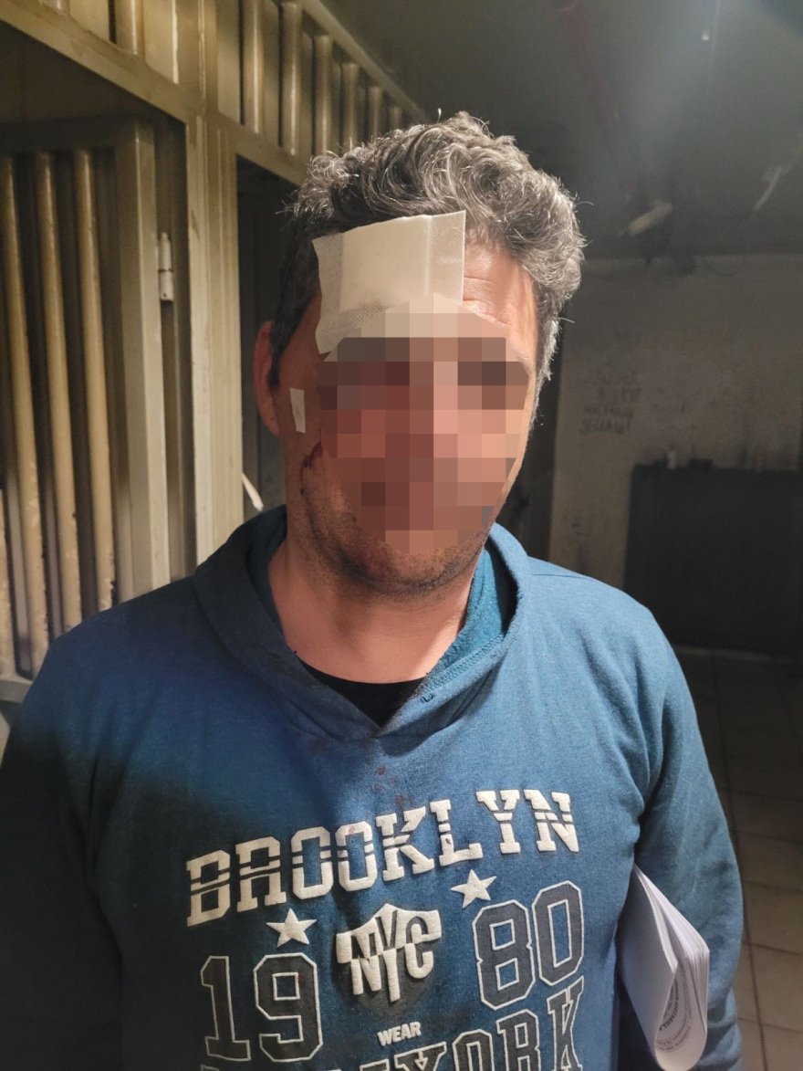 Super Κική: Ο άνδρας που κατήγγειλε ότι ξυλοκοπήθηκε από γνωστό της αναγνώρισε τον θύτη του