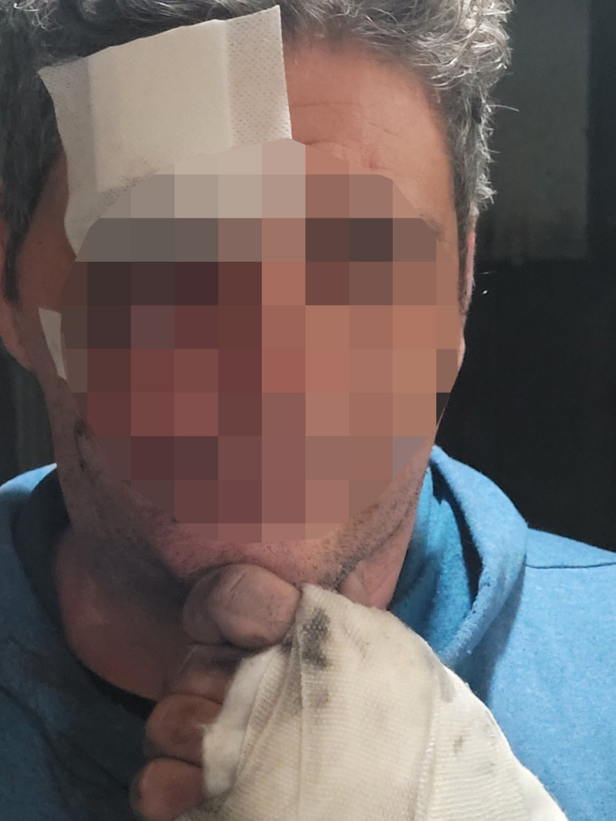 Super Κική: Ο άνδρας που κατήγγειλε ότι ξυλοκοπήθηκε από γνωστό της αναγνώρισε τον θύτη του