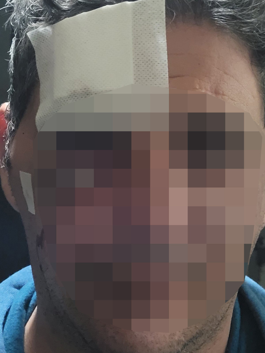 Super Κική: Ο άνδρας που κατήγγειλε ότι ξυλοκοπήθηκε από γνωστό της αναγνώρισε τον θύτη του