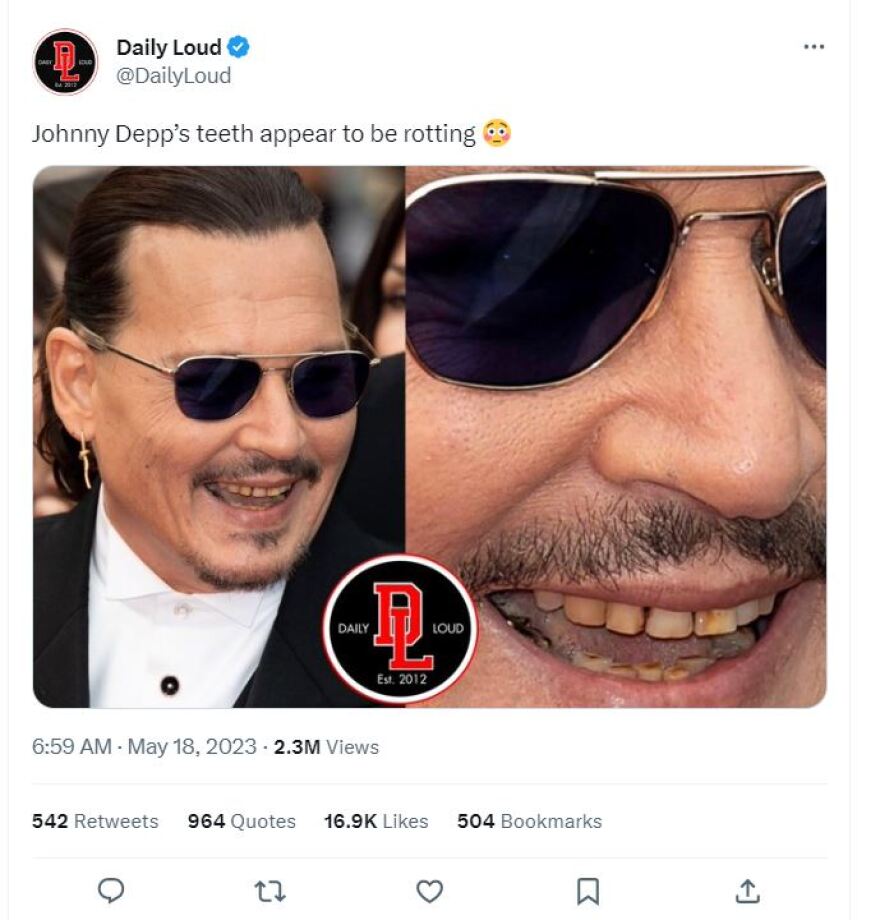 Τζόνι Ντεπ: Χαμός στο Twitter με την εμφάνισή του στις Κάννες λόγω των... δοντιών του