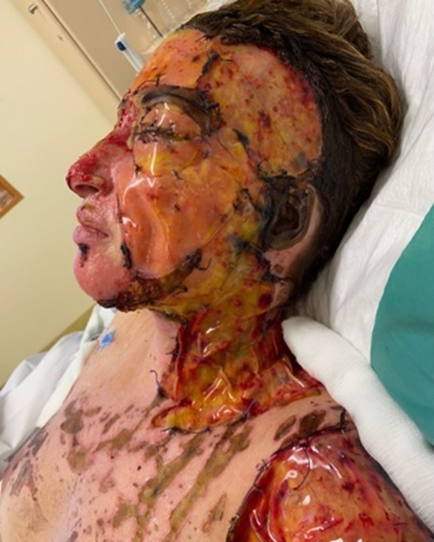 Ιωάννα Παλιοσπύρου: Η συγκλονιστική ανάρτηση με φωτογραφίες από τα χειρουργεία - Προσοχή σκληρές εικόνες